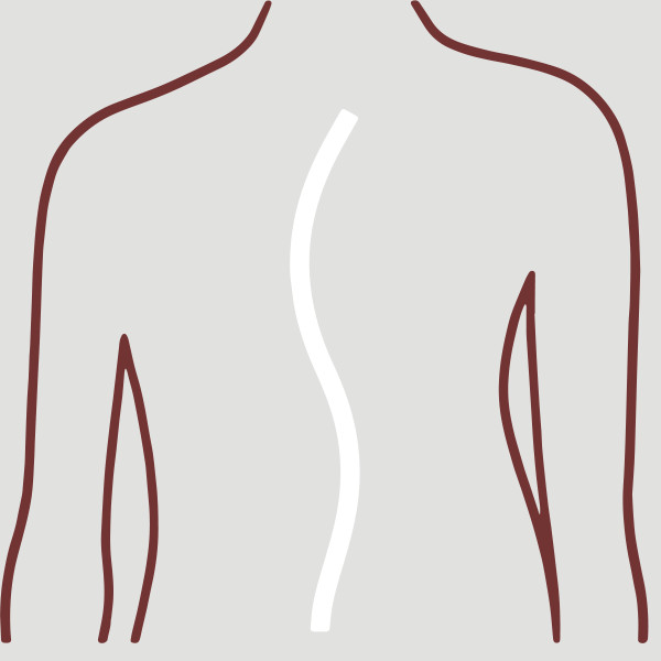 A sketch of a deformed spine