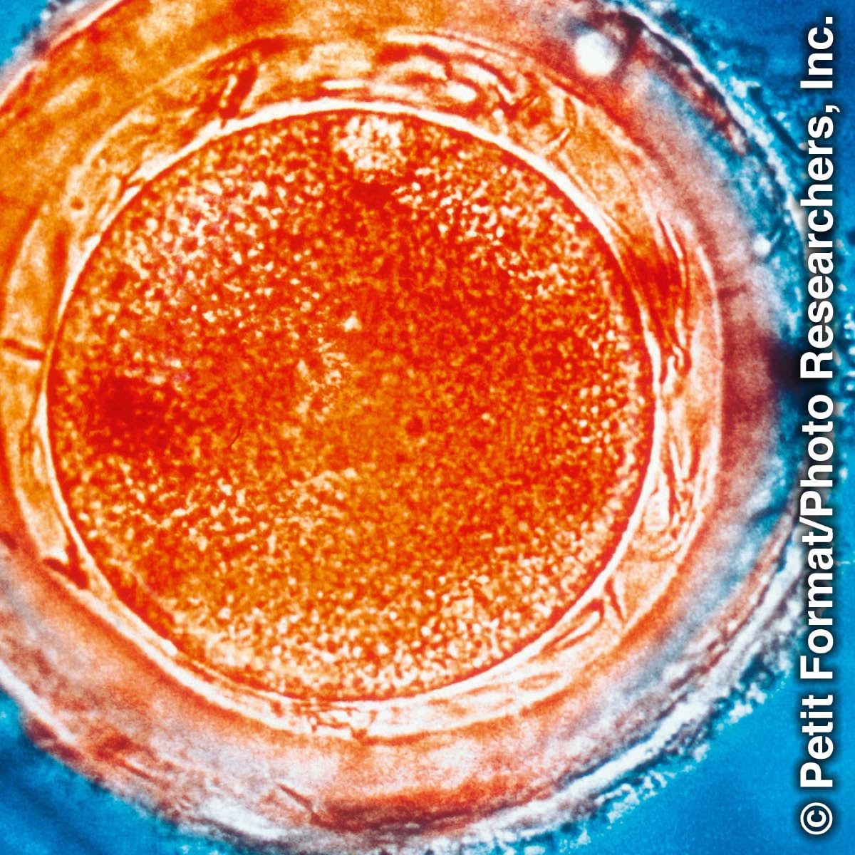 Frjóvguð eggfruma konu