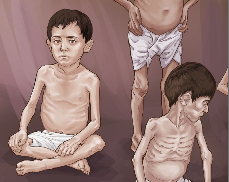 Naupang ṭâmte