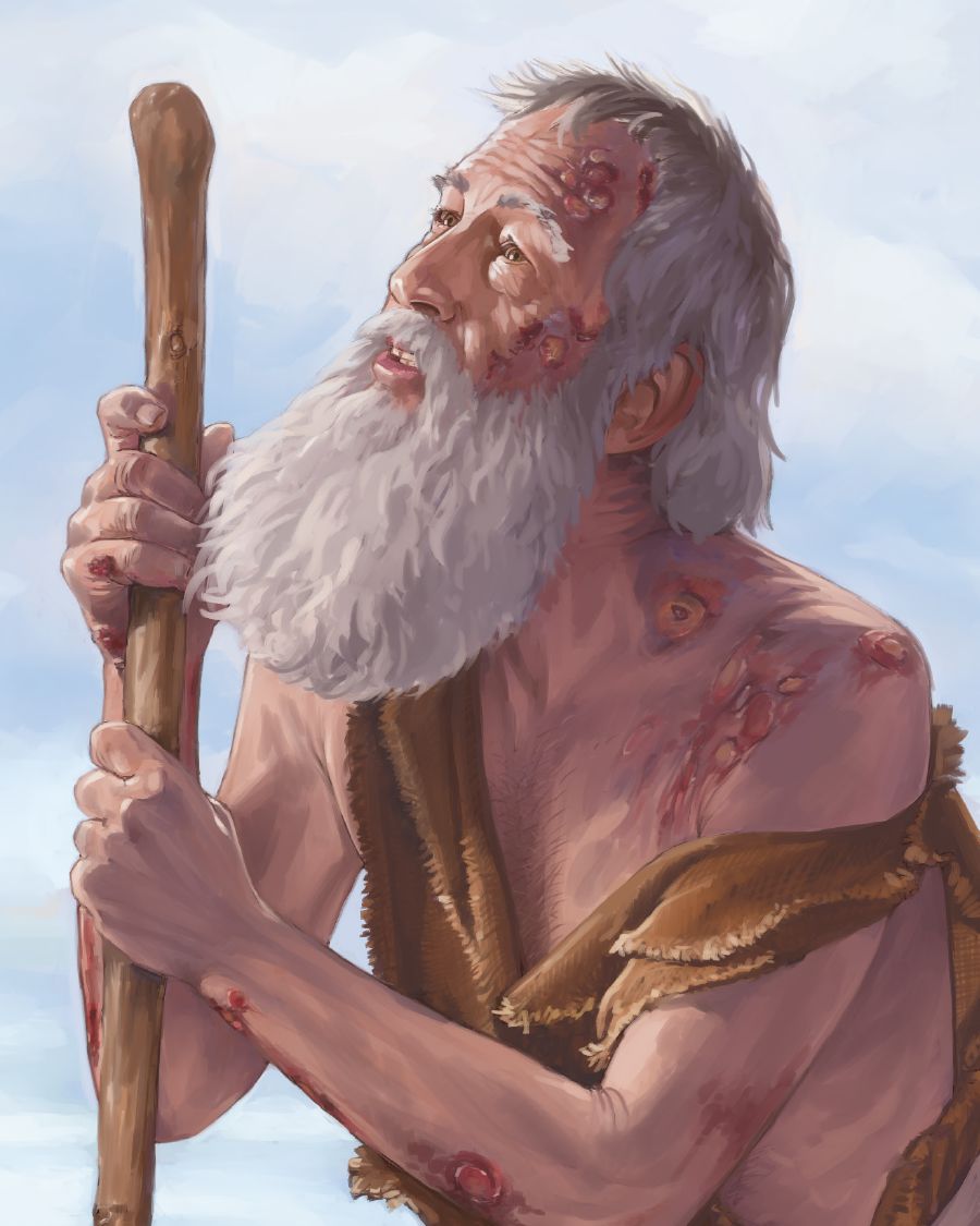 Ir-raġel Ġob bi nfafet fuq ġismu