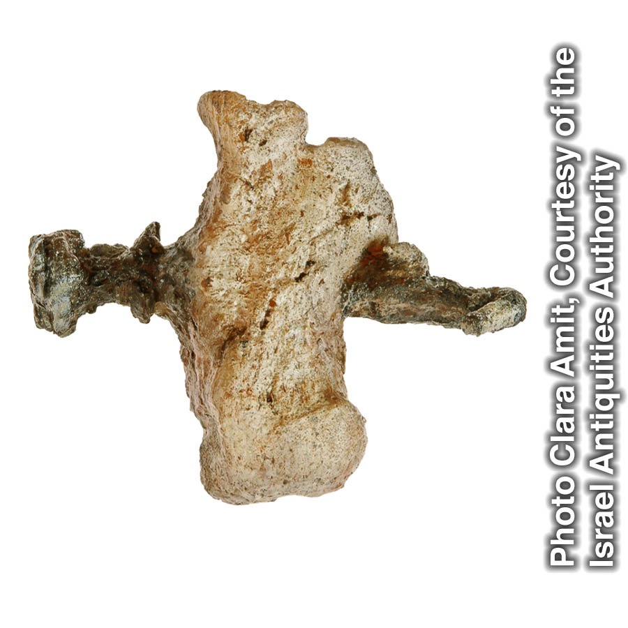 A human heel bone pierced by a nail